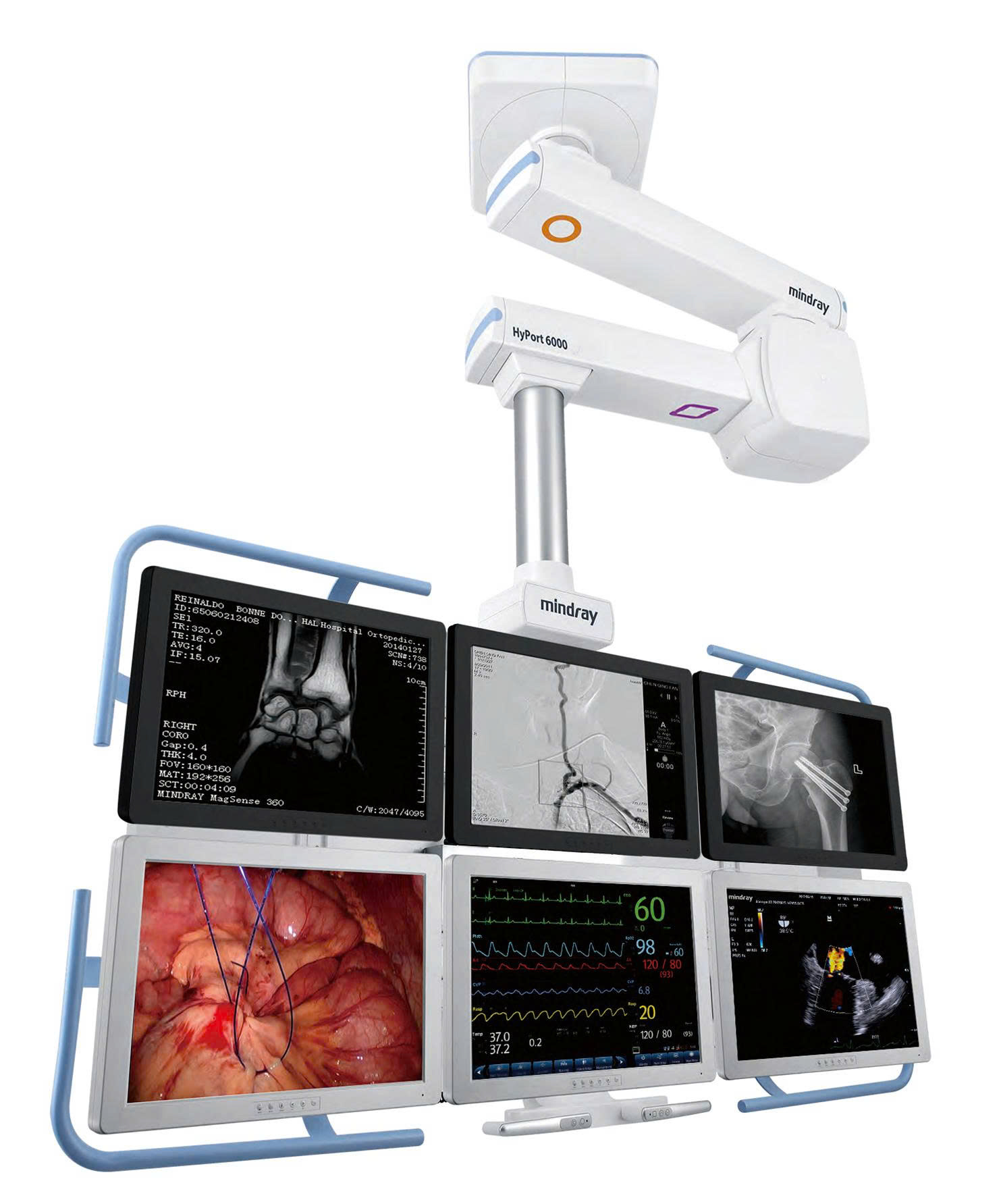 Hệ thống cánh tay treo trần phòng mổ - Model: HyPort P30/P60/P90 - 5