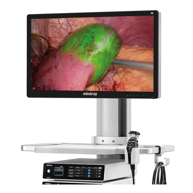 Hệ thống phẫu thuật nội soi UX5 có 3D và huỳnh quang (ICG)